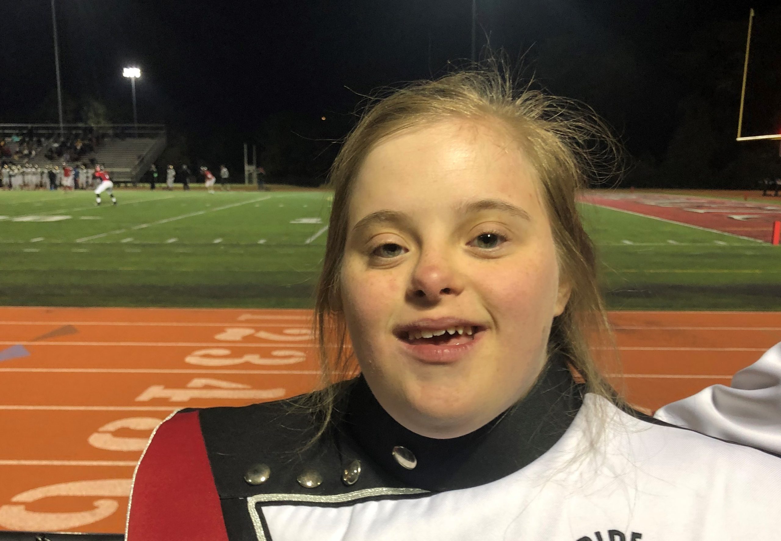 Keratoconus Journey: Sarah